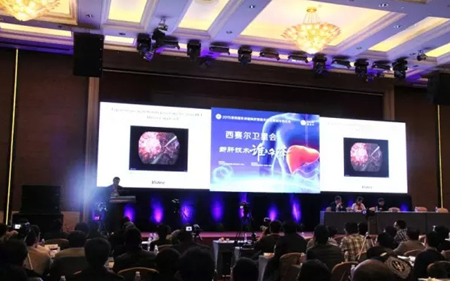 第四届杭州国际肝胆胰外科及微创外科大会现场图片