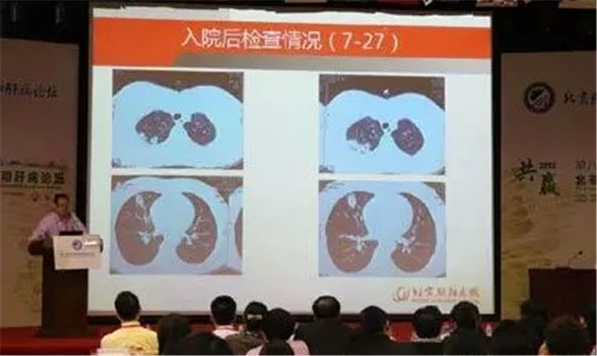 第八届北京感染和肝病论坛现场图片